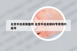 北京中日皮膚醫(yī)院 北京中日皮膚科專家預約掛號