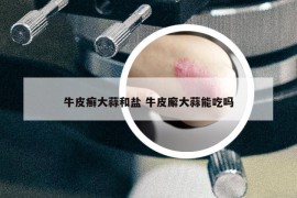 牛皮癬大蒜和鹽 牛皮廨大蒜能吃嗎