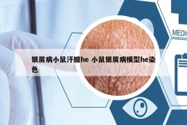 銀屑病小鼠汗腺he 小鼠銀屑病模型he染色