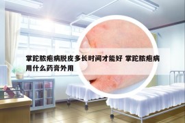 掌跎膿皰病脫皮多長(zhǎng)時(shí)間才能好 掌跎膿皰病用什么藥膏外用