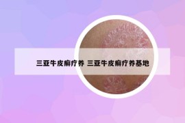 三亞牛皮癬療養(yǎng) 三亞牛皮癬療養(yǎng)基地