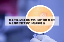 北京空軍總院皮膚科專家門診時間表 北京空軍總院皮膚科專家門診時間表電話