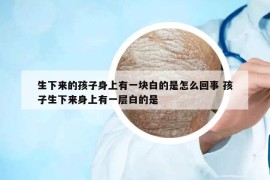 生下來(lái)的孩子身上有一塊白的是怎么回事 孩子生下來(lái)身上有一層白的是