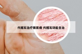 代赭石治療銀屑病 代赭石功能主治