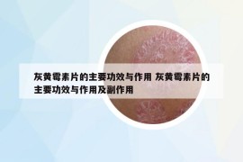 灰黃霉素片的主要功效與作用 灰黃霉素片的主要功效與作用及副作用