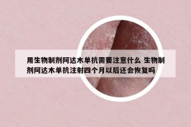 用生物制劑阿達(dá)木單抗需要注意什么 生物制劑阿達(dá)木單抗注射四個月以后還會恢復(fù)嗎