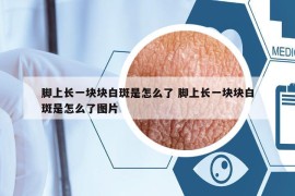 腳上長一塊塊白斑是怎么了 腳上長一塊塊白斑是怎么了圖片