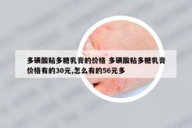 多磺酸粘多糖乳膏的價格 多磺酸粘多糖乳膏價格有的30元,怎么有的56元多