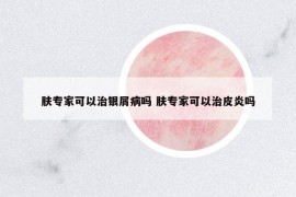 膚專家可以治銀屑病嗎 膚專家可以治皮炎嗎