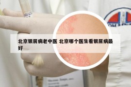 北京銀屑病老中醫(yī) 北京哪個(gè)醫(yī)生看銀屑病最好