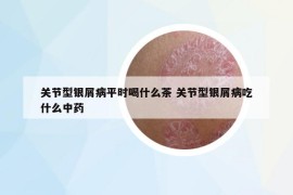 關(guān)節(jié)型銀屑病平時(shí)喝什么茶 關(guān)節(jié)型銀屑病吃什么中藥