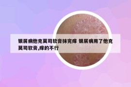 銀屑病他克莫司軟膏抹完癢 銀屑病用了他克莫司軟膏,癢的不行