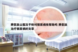 脾氨肽口服凍干粉對(duì)銀屑病有幫助嗎 脾氨肽治療銀屑病的文章