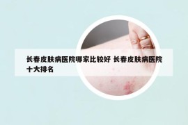 長(zhǎng)春皮膚病醫(yī)院哪家比較好 長(zhǎng)春皮膚病醫(yī)院十大排名