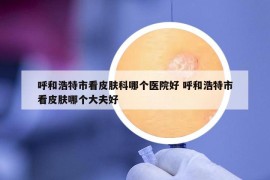 呼和浩特市看皮膚科哪個醫(yī)院好 呼和浩特市看皮膚哪個大夫好