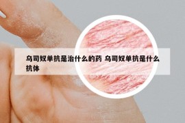 烏司奴單抗是治什么的藥 烏司奴單抗是什么抗體