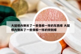 大腿根內(nèi)側(cè)長(zhǎng)了一些像癬一樣的東西癢 大腿根內(nèi)側(cè)長(zhǎng)了一些像癬一樣的特別癢