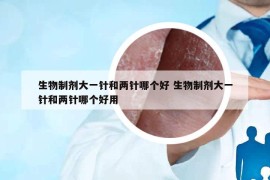 生物制劑大一針和兩針哪個(gè)好 生物制劑大一針和兩針哪個(gè)好用