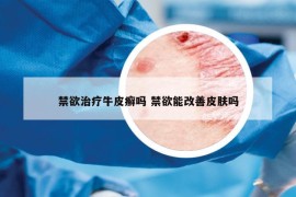 禁欲治療牛皮癬嗎 禁欲能改善皮膚嗎