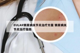 EULAR銀屑病關(guān)節(jié)炎治療方案 銀屑病關(guān)節(jié)炎治療指南