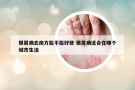 銀屑病去南方能不能好些 銀屑病適合在哪個(gè)城市生活