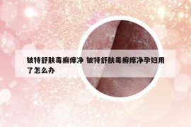 鈹特舒膚毒癬癢凈 鈹特舒膚毒癬癢凈孕婦用了怎么辦