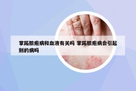 掌跖膿皰病和血液有關(guān)嗎 掌跖膿皰病會引起別的病嗎