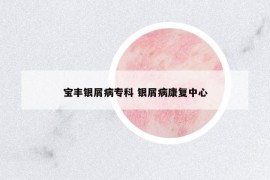 寶豐銀屑病專(zhuān)科 銀屑病康復(fù)中心