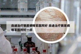 南通治療銀屑病哪家醫(yī)院好 南通治療銀屑病哪家醫(yī)院好一點(diǎn)