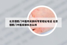 北京德勝門中醫(yī)院皮膚科專家地址電話 北京德勝門中醫(yī)皮膚科怎么樣