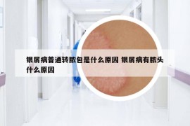 銀屑病普通轉(zhuǎn)膿包是什么原因 銀屑病有膿頭什么原因