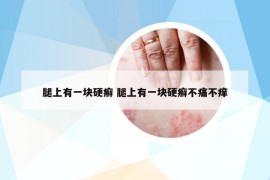 腿上有一塊硬癬 腿上有一塊硬癬不痛不癢