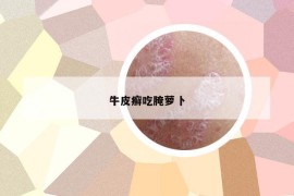 牛皮癬吃腌蘿卜