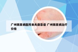 廣州銀屑病醫(yī)院來夫康靠譜 廣州銀屑病治療價(jià)格