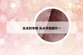 白點(diǎn)的早期 白點(diǎn)早期圖片一