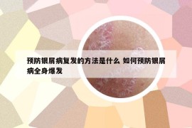 預(yù)防銀屑病復(fù)發(fā)的方法是什么 如何預(yù)防銀屑病全身爆發(fā)