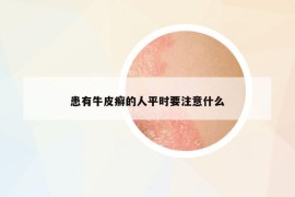 患有牛皮癬的人平時要注意什么