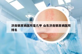 濟(jì)南銀屑病醫(yī)院是幾甲 山東濟(jì)南銀屑病醫(yī)院排名