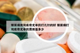 銀屑病用司庫奇尤單抗打幾針的好 銀屑病打司庫奇尤單抗費用是多少