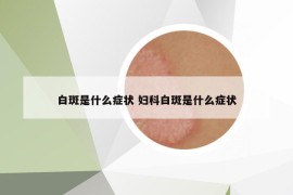 白斑是什么癥狀 婦科白斑是什么癥狀