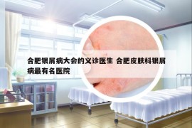 合肥銀屑病大會(huì)的義診醫(yī)生 合肥皮膚科銀屑病最有名醫(yī)院