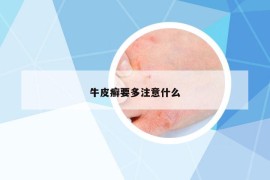 牛皮癬要多注意什么