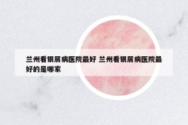 蘭州看銀屑病醫(yī)院最好 蘭州看銀屑病醫(yī)院最好的是哪家