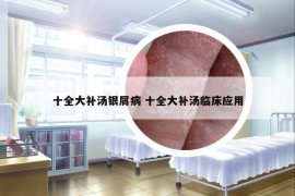 十全大補(bǔ)湯銀屑病 十全大補(bǔ)湯臨床應(yīng)用