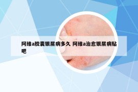 阿維a膠囊銀屑病多久 阿維a治愈銀屑病貼吧