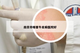 南京市哪里牛皮癬醫(yī)院好