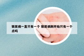 銀屑病一直只有一個 銀屑病剛開始只有一個點(diǎn)嗎