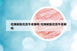 吃辣椒能吃出牛皮癬嗎 吃辣椒能吃出牛皮癬嗎
