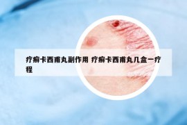 療癬卡西甫丸副作用 療癬卡西甫丸幾盒一療程