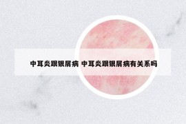 中耳炎跟銀屑病 中耳炎跟銀屑病有關(guān)系嗎